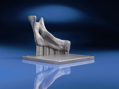 Partial replica of a jaw human carried out layer by layer. Photo: Fraunhofer IFAM, Bremen