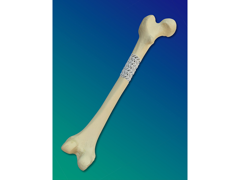 O suporte sseo do projeto SCABAEGO pode ser personalizado para se adaptar a qualquer tamanho de osso longo...