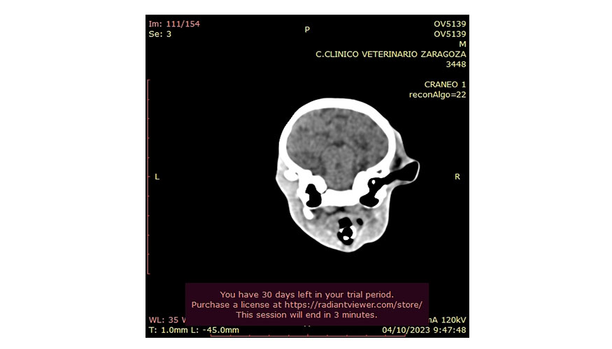Figura 1. Cortes frontales de la tomograf�a computarizada (TC) realizada al cordero n� 2. a. Surcos radiol�cidos compatibles con atrofia cortical. b...