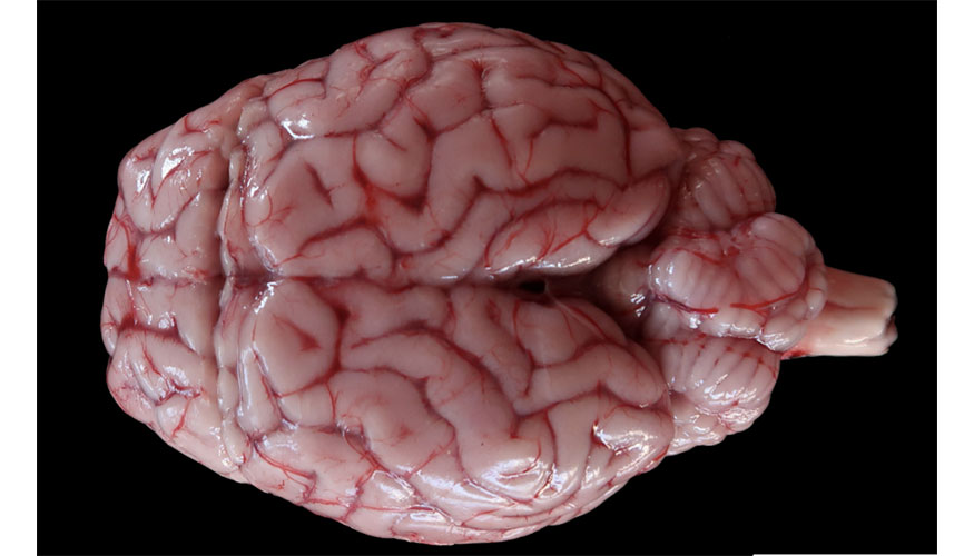 Figura 3. Lesiones macrosc�picas del enc�falo del cordero de cebo, compatibles con ataxia enzo�tica. Edema cerebral. b...