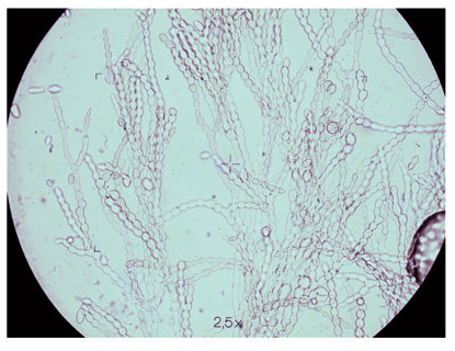 Figure 4: Conidias of Monilinia spp.. (x 100)