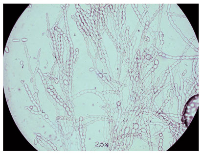 Figura 4: Conidias de Monilinia spp. (x100)