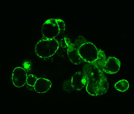 Imagen de los cultivos celulares de 'Arabidopsis thaliana' al microscopio. Foto: Juan Arellano, Irnasa