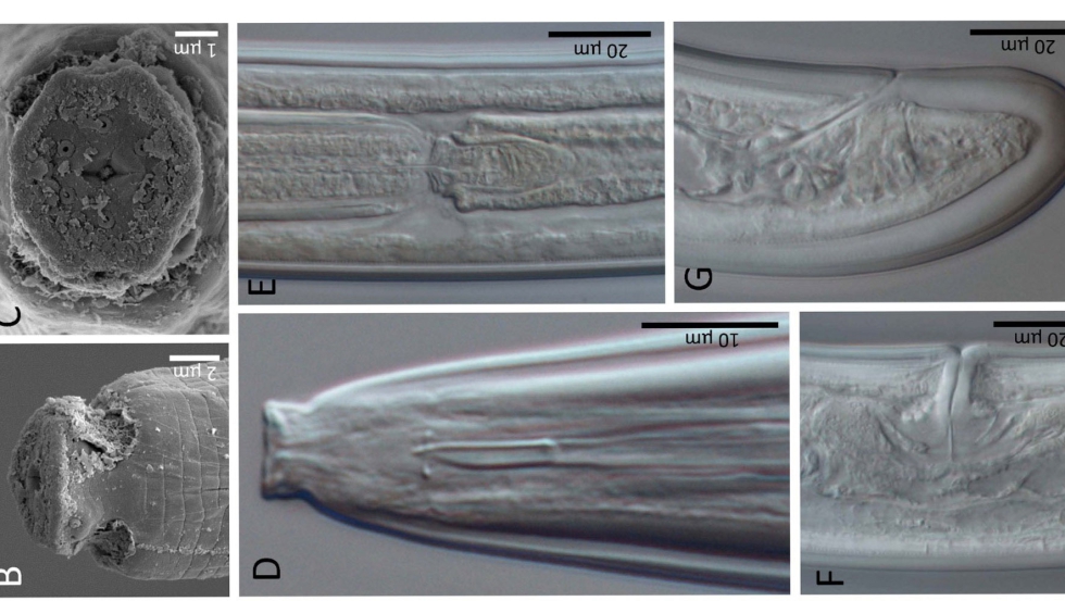 Imgenes aumentadas del neumatodo