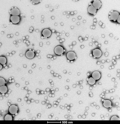 Foto obtenida mediante microscopio TEM de uno de los polmeros en base acuosa (ltex) que la autora ha sintetizado. (Foto: InsMariz)...