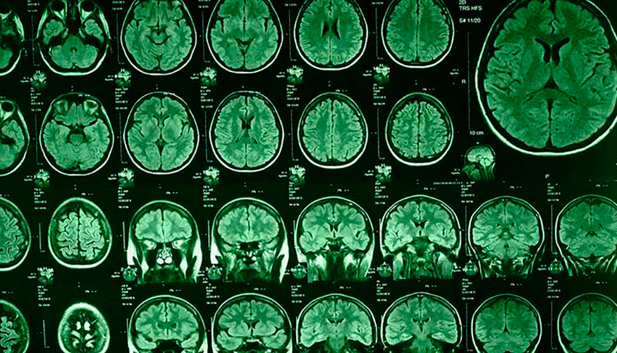 El escaneado por TC es una solucin no invasiva para observar el interior del cuerpo...