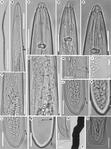 'Rotylenchus vitis', descubierto en algunos viedos andaluces