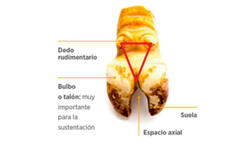 Figura 1. Espacio triangular donde se hallan la mayora de las lesiones de DD. Adaptado de Bellet 2021