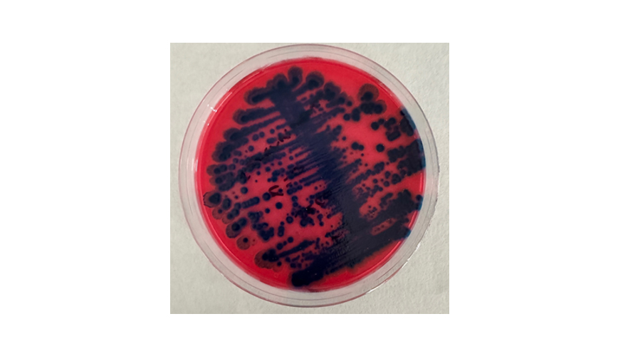 Figura 2. Evaluacin de supervivencia. Presencia de B. thuringiensis