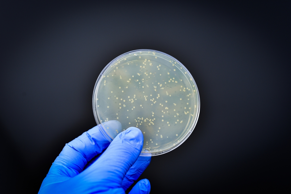 Investigadores do CSIC efetuam uma sequenciao extensiva dos genes de resistncia bacteriana presentes na cadeia alimentar...