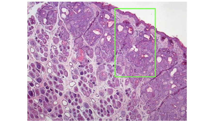 Imagen 3. Biopsia del animal caso te�ida con H&E...