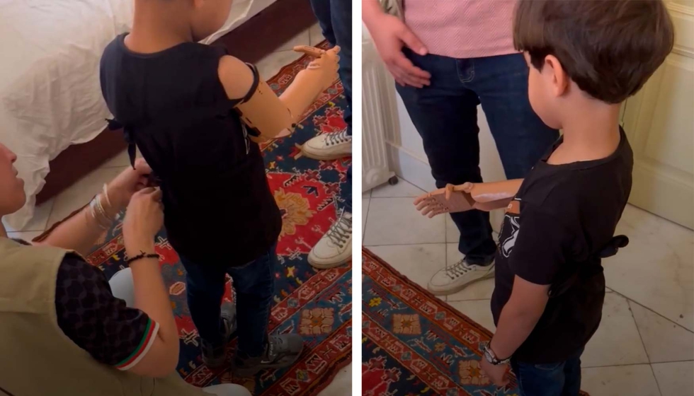 Omar prueba su pr�tesis de Ay�dame3D