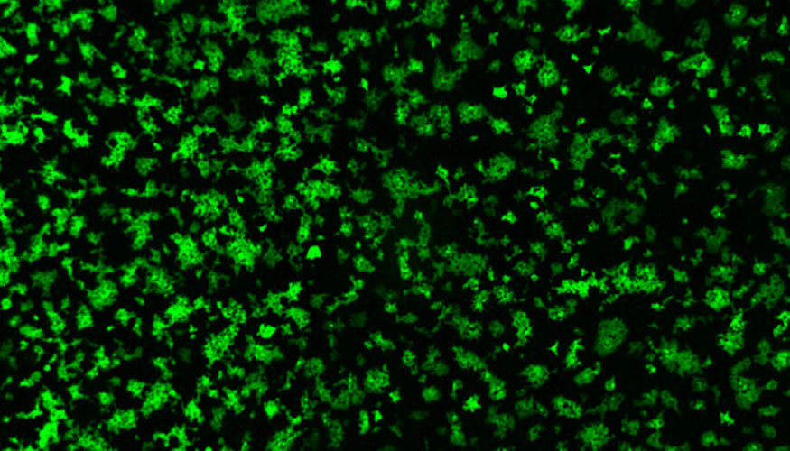 Imagen de microscopio de clulas fusionadas tras expresar la protena spike del coronavirus porcino PHEV y de su receptor (DPEP1)...