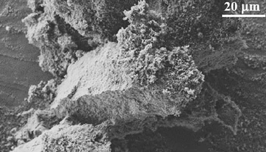 Estructura microsc�pica del catalizador procedente de los huesos...