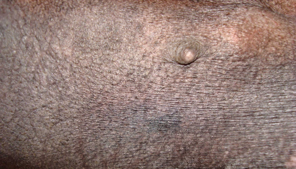 Figura 2. Piel de perro al�rgico, donde son muy importantes los �cidos grasos escenciales como factores de recuperaci�n...