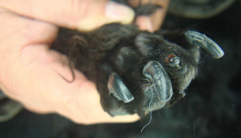 Figura 3. Enfermedad de las u�as con deficiencia de biotina