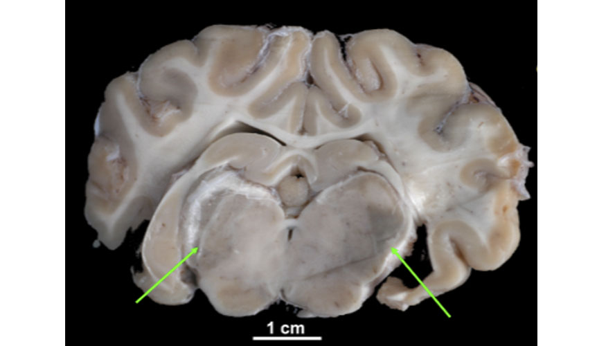 Figura 2. Secci�n longitudinal del enc�falo...