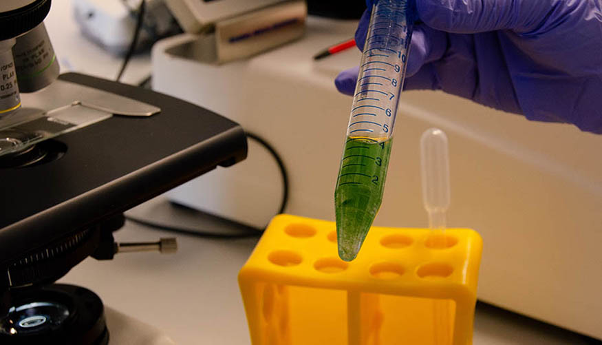 An�lisis de las microalgas que depuran las aguas residuales
