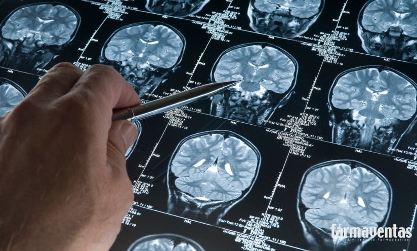 Foto de La Medicina de Precisi�n avanza hacia el diagn�stico biol�gico del Alzheimer