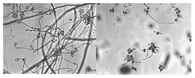 Figura 4: Efecto de una levadura aislada de filoplano sobre la germinacin de conidias de Botrytis cinerea (derecha) y control (izquierda)...