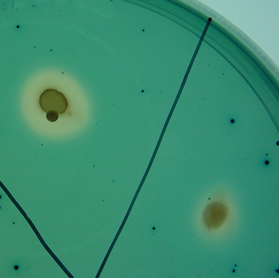 Figura 2: Los halos anaranjados alrededor de las colonias muestran la produccin de siderforos por las cepas TPV08 (izquierda) y PETP01 (derecha)...