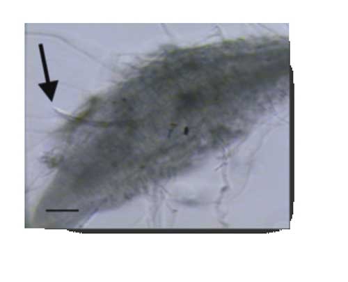 Larva (flecha) de M. incgnita parasitada por Rhizobium spp