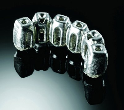 Implantes dentales producidos con Matsuura Lumex Avance 25