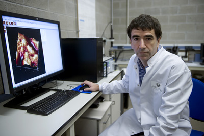 Jose Ramon Sarasua Oiz, profesor doctor del rea de Ciencia e Ingeniera de Materiales, informa sobre los beneficios del biovidrio...