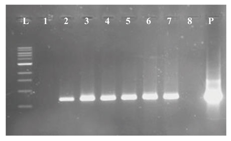 Figura 3: Amplificacin mediante PCR de un fragmento del gen nptII presente en plantas de ciruelo transformadas...