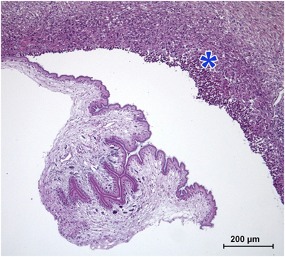 Microfotografa de una tincin hematoxilina-eosina de Cysticercus bovis, el estado larvario de Taenia saginata. Fuente: SESC...