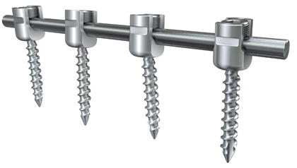 The heads of tulipa for the vertebral pieces are ideal for the mechanised in machines of cabezal mobile modern