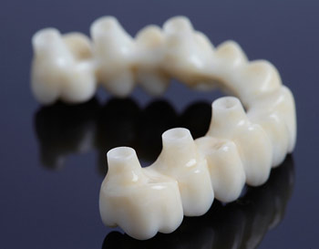 Hamburguesa Fobia intercambiar Impresión 3D en el ámbito de la implantología dental - Metalmecánica