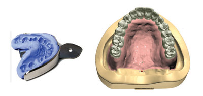El siguiente paso, el escaner intraoral, asegura que la imagen 3D obtenida es idntica a la boca del paciente