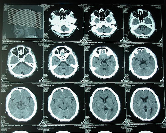 Neurologa, radiografa. Imagen de Flickr