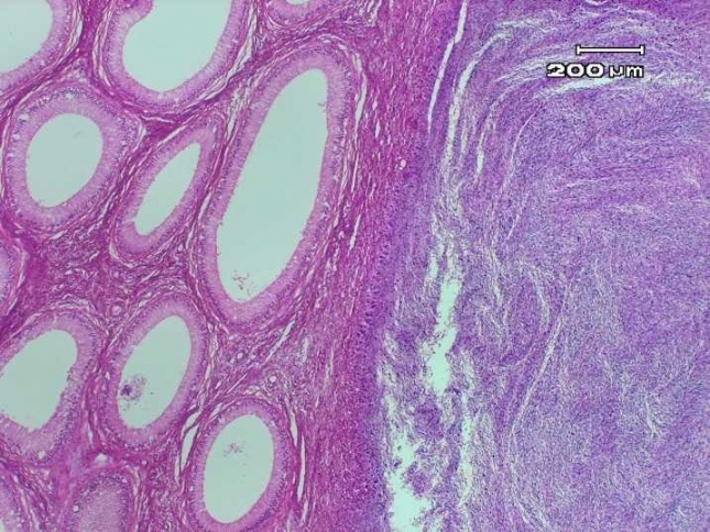 Especialistas mejicanas estudian un gen relacionado con virulencia de la brucelosis en ovino, que facilitar� el desarrollo de nuevas vacunas