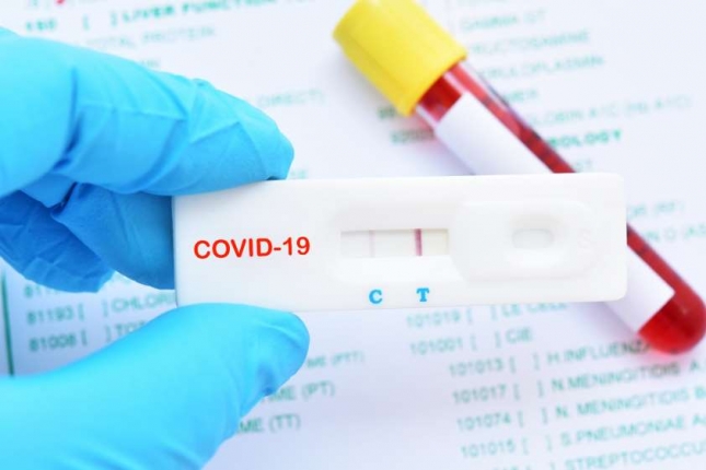 La OCV advierte sobre la infrautilizacin de laboratorios veterinarios en el coronavirus